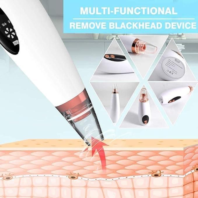 6 in 1 Multi - function Blackhead Remover Tools - Trenditeam.com