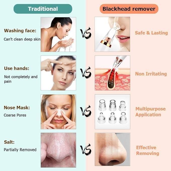 6 in 1 Multi - function Blackhead Remover Tools - Trenditeam.com